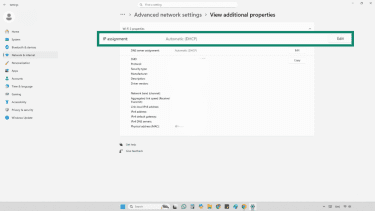 Screenshot of IP assignment in advanced network settings in Windows 11